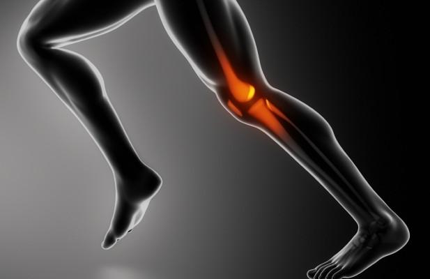 Sports knee injury x-ray concept